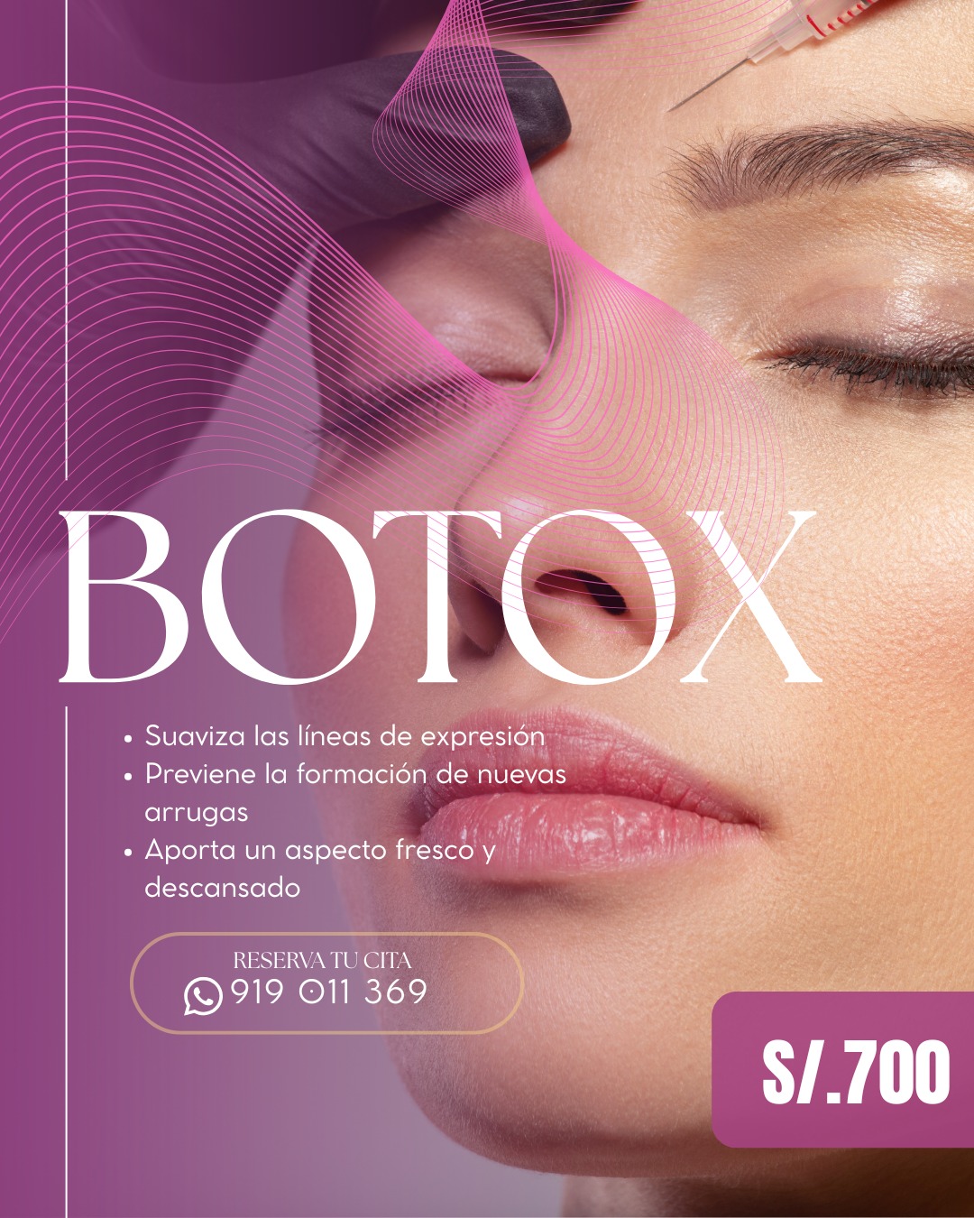 Botox — S/ 700