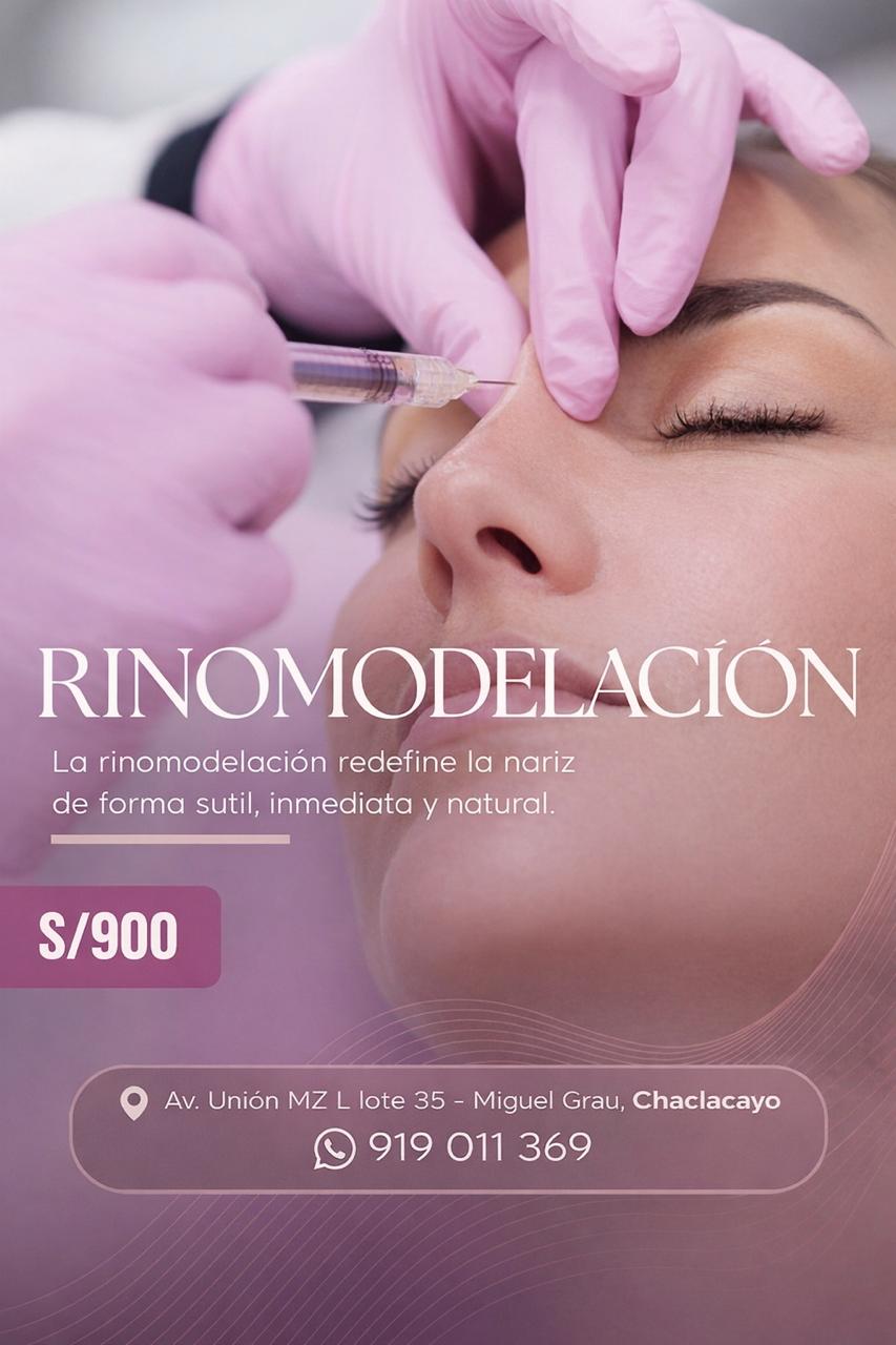 Rinomodelación sin cirugía — S/ 900